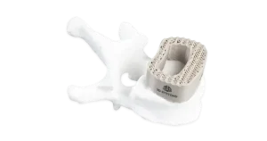 3d-systems-hsg-meddevice-ext220med-spinal-cage-image.png