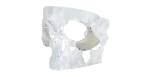 3d-systems-onlay-image.png