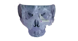 3d-systems-orbital-image.png