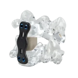 3d-systems-spinal-cage-cfr-peek-material-hero_0.png