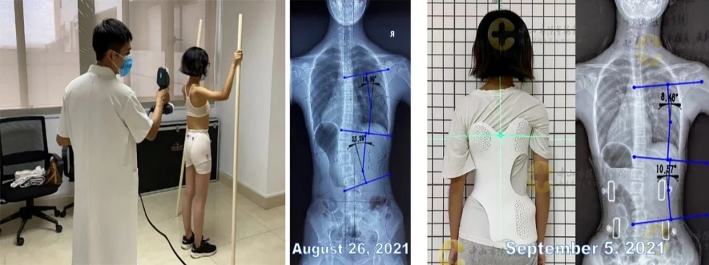 Dự án y tế 1