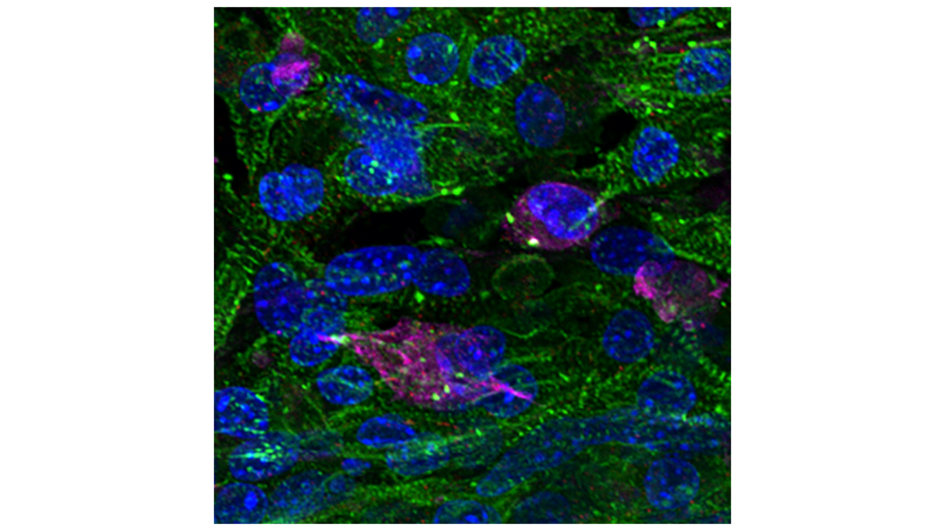MÔ HÌNH HÓA BỆNH HỌC (DISEASE MODELLING)