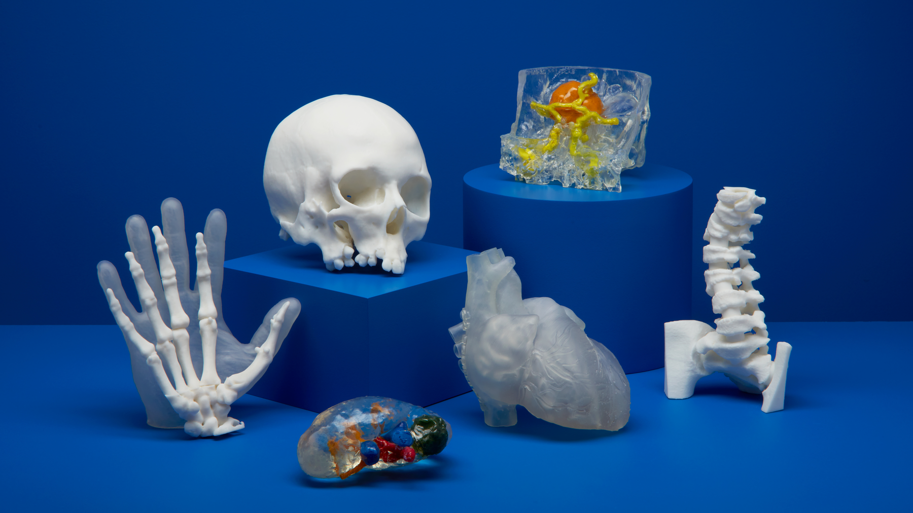 Ứng dụng công nghệ in 3D trong y tế: Từ mô hình phẫu thuật đến implant tùy chỉnh