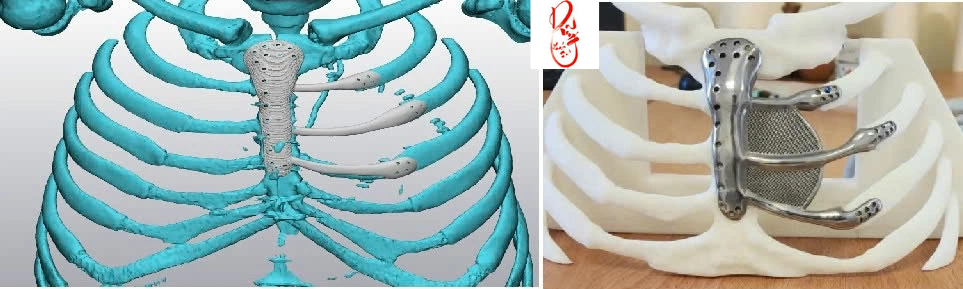 Công nghệ in 3D kim loại (Metal 3D Printing)